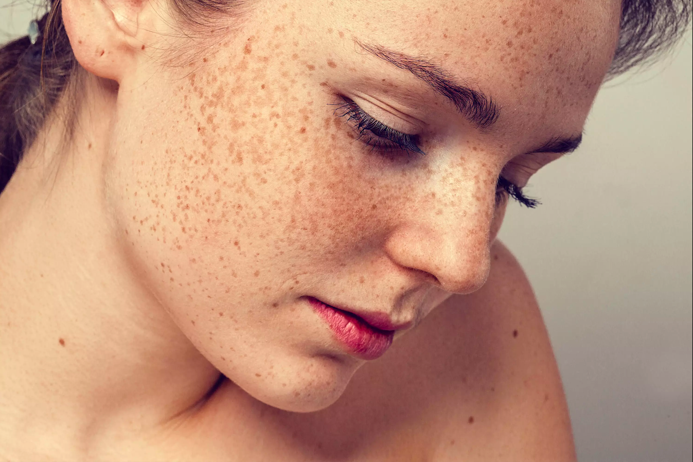 People with freckles know how damaging it can be to a perfect face. 
