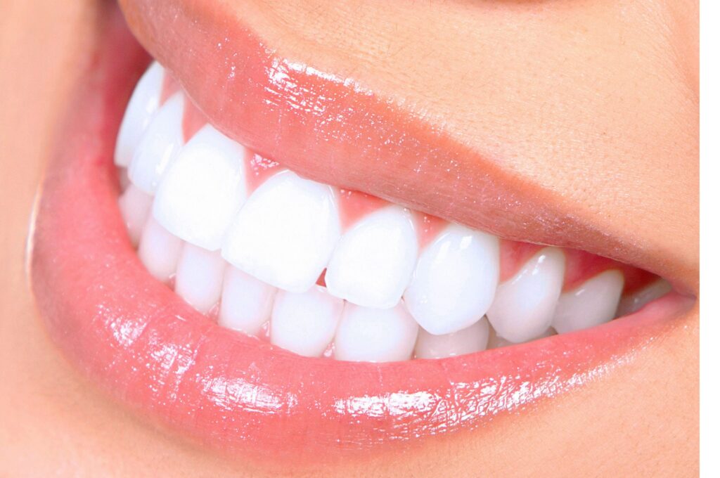 teeth-smile-girl-dental-white